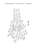 SYSTEMS FOR PATIENT SUPPORT SURFACE ORIENTATION AND DISPLACEMENT diagram and image