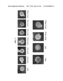 METHODS AND COMPOSITIONS FOR PREVENTING OR TREATING OPHTHALMIC CONDITIONS diagram and image