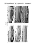 METHODS AND COMPOSITIONS FOR PREVENTING OR TREATING OPHTHALMIC CONDITIONS diagram and image