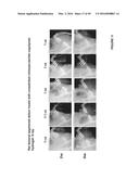 CROSSLINKED CHITOSAN-LACTIDE HYDROGELS diagram and image