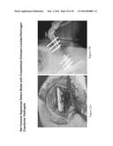 CROSSLINKED CHITOSAN-LACTIDE HYDROGELS diagram and image