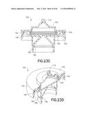 COLLAPSIBLE SYRINGE FOR FLUID DELIVERY SYSTEM diagram and image