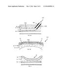 CRYOLIPOLYSIS DEVICES AND METHODS THEREFOR diagram and image