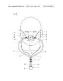 CANNULA DEVICE diagram and image