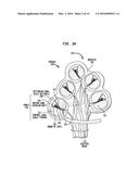 INTRA-COCHLEAR STIMULATING ASSEMBLY INSERTION diagram and image