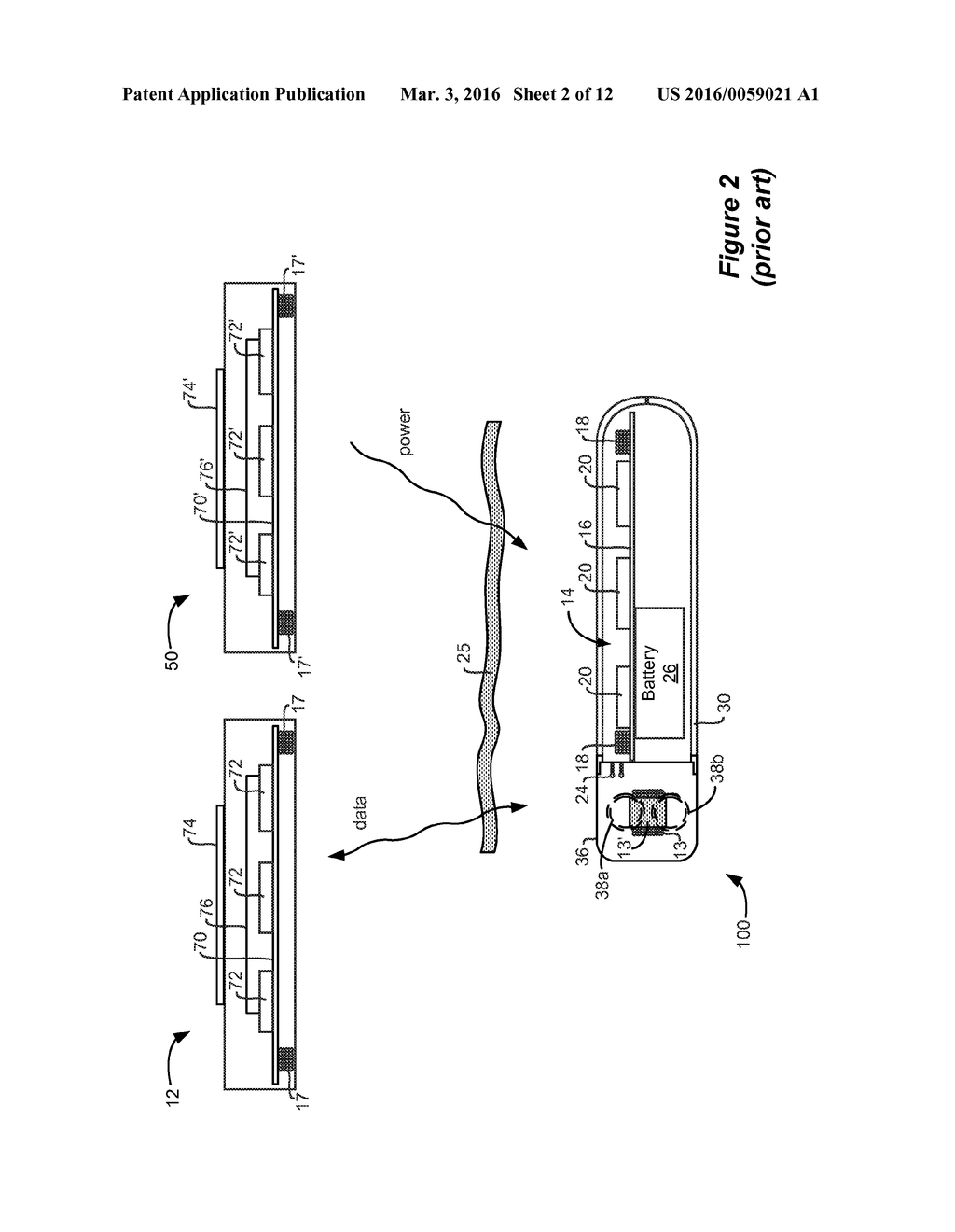 Charging System for an Implantable Medical Device Employing Magnetic and     Electric Fields - diagram, schematic, and image 03