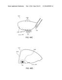 GOLF CLUB HEAD diagram and image