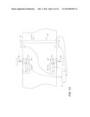 REDUCING TENSION FLUCTUATIONS USING ISOLATED TENSION ZONES diagram and image