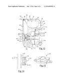 FIXING METHOD OF WHEEL COVER diagram and image