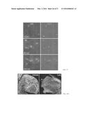 COMPOUNDS FOR TREATMENT OF ANGIOGENESIS-MEDIATED DISEASES diagram and image