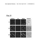 TARGETING TRASTUZUMAB-RESISTANT HER2+ BREAST CANCER WITH A HER3-TARGETING     NANOPARTICLE diagram and image