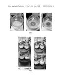 CHEMICAL PULPING OF CHITINOUS BIOMASS FOR CHITIN diagram and image