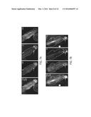 FUNCTIONAL MYELINATION OF NEURONS diagram and image