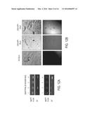 FUNCTIONAL MYELINATION OF NEURONS diagram and image