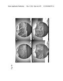 BULK NICKEL-BASED CHROMIUM AND PHOSPHOROUS BEARING METALLIC GLASSES diagram and image