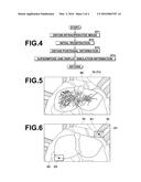 IMAGE REGISTRATION DEVICE, IMAGE REGISTRATION METHOD, AND IMAGE     REGISTRATION PROGRAM diagram and image