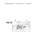 IMAGE REGISTRATION DEVICE, IMAGE REGISTRATION METHOD, AND IMAGE     REGISTRATION PROGRAM diagram and image