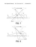 IMAGE PROCESSING APPARATUS, RADIATION TOMOGRAPHY APPARATUS, AND METHOD OF     PERFORMING IMAGE PROCESSING diagram and image