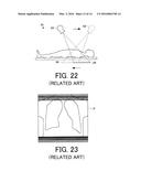 IMAGE PROCESSING APPARATUS, RADIATION TOMOGRAPHY APPARATUS, AND METHOD OF     PERFORMING IMAGE PROCESSING diagram and image