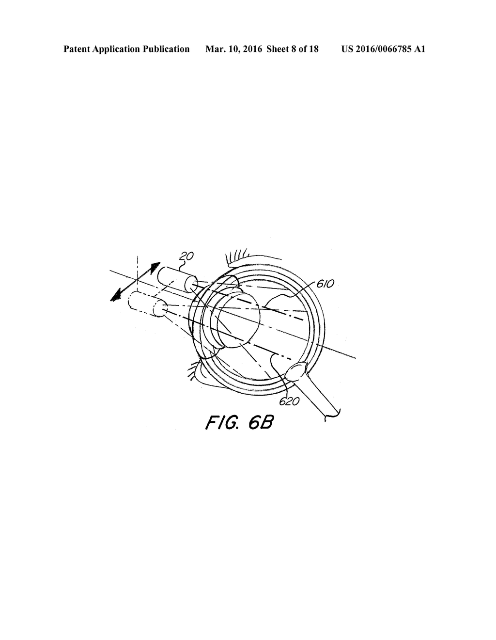 System And Method for Visualization of Ocular Anatomy - diagram, schematic, and image 09