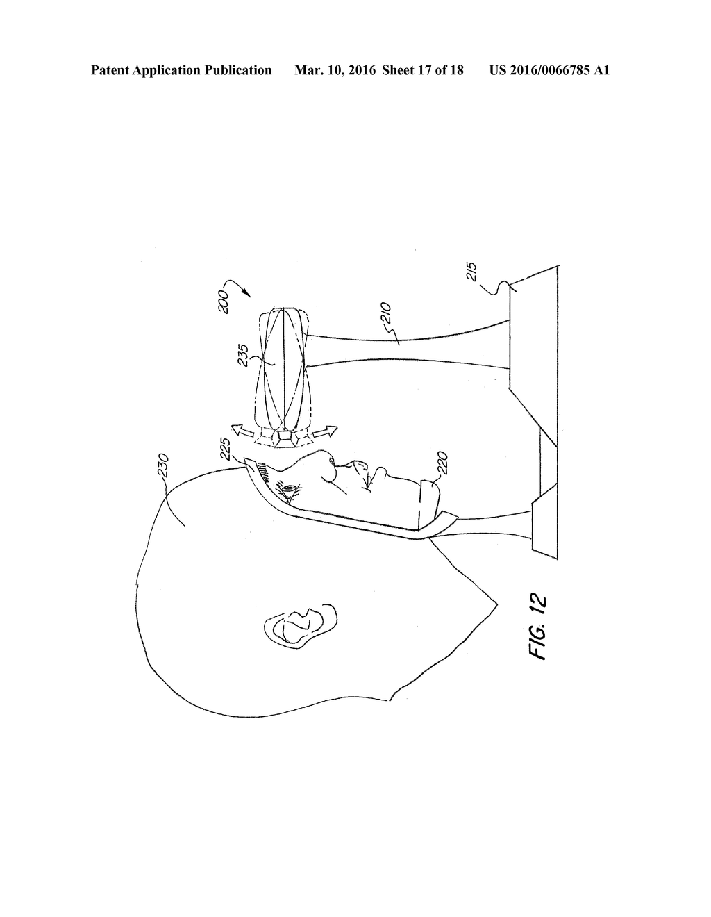 System And Method for Visualization of Ocular Anatomy - diagram, schematic, and image 18