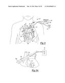 Determining A Location Of A Member diagram and image