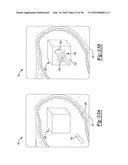 Determining A Location Of A Member diagram and image