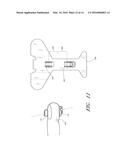 OPTICAL SENSOR INCLUDING DISPOSABLE AND REUSABLE ELEMENTS diagram and image