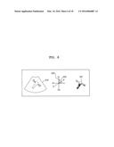 IMAGE INDICATOR PROVISION IN ULTRASOUND SYSTEM diagram and image