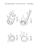 FEATURE TO LOCK KNOB OF TISSUE STAPLER diagram and image