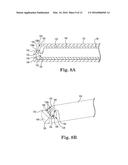 TUMOR MARGIN DEVICE diagram and image