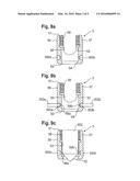 BONE ANCHORING DEVICE diagram and image