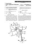 SYSTEMS AND METHODS FOR POSTERIOR DYNAMIC STABILIZATION OF THE SPINE diagram and image