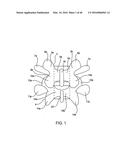 SYSTEMS AND METHODS FOR POSTERIOR DYNAMIC STABILIZATION OF THE SPINE diagram and image