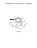 SYSTEMS AND METHODS FOR POSTERIOR DYNAMIC STABILIZATION OF THE SPINE diagram and image