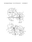 SYSTEMS AND METHODS FOR POSTERIOR DYNAMIC STABILIZATION OF THE SPINE diagram and image