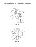 SYSTEMS AND METHODS FOR POSTERIOR DYNAMIC STABILIZATION OF THE SPINE diagram and image