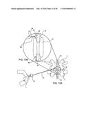 SYSTEMS AND METHODS FOR POSTERIOR DYNAMIC STABILIZATION OF THE SPINE diagram and image