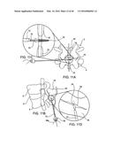 SYSTEMS AND METHODS FOR POSTERIOR DYNAMIC STABILIZATION OF THE SPINE diagram and image