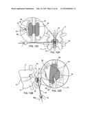 SYSTEMS AND METHODS FOR POSTERIOR DYNAMIC STABILIZATION OF THE SPINE diagram and image