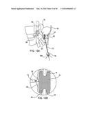 SYSTEMS AND METHODS FOR POSTERIOR DYNAMIC STABILIZATION OF THE SPINE diagram and image