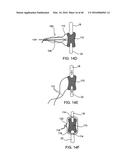 SYSTEMS AND METHODS FOR POSTERIOR DYNAMIC STABILIZATION OF THE SPINE diagram and image