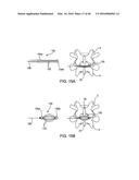 SYSTEMS AND METHODS FOR POSTERIOR DYNAMIC STABILIZATION OF THE SPINE diagram and image