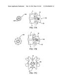 SYSTEMS AND METHODS FOR POSTERIOR DYNAMIC STABILIZATION OF THE SPINE diagram and image