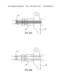 SYSTEMS AND METHODS FOR POSTERIOR DYNAMIC STABILIZATION OF THE SPINE diagram and image