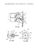 SYSTEMS AND METHODS FOR POSTERIOR DYNAMIC STABILIZATION OF THE SPINE diagram and image