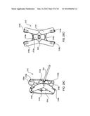 SYSTEMS AND METHODS FOR POSTERIOR DYNAMIC STABILIZATION OF THE SPINE diagram and image