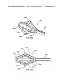 SYSTEMS AND METHODS FOR POSTERIOR DYNAMIC STABILIZATION OF THE SPINE diagram and image