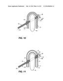 DEVICE AND METHOD FOR CORRECTING A SPINAL DEFORMITY diagram and image