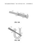 DEVICE AND METHOD FOR CORRECTING A SPINAL DEFORMITY diagram and image